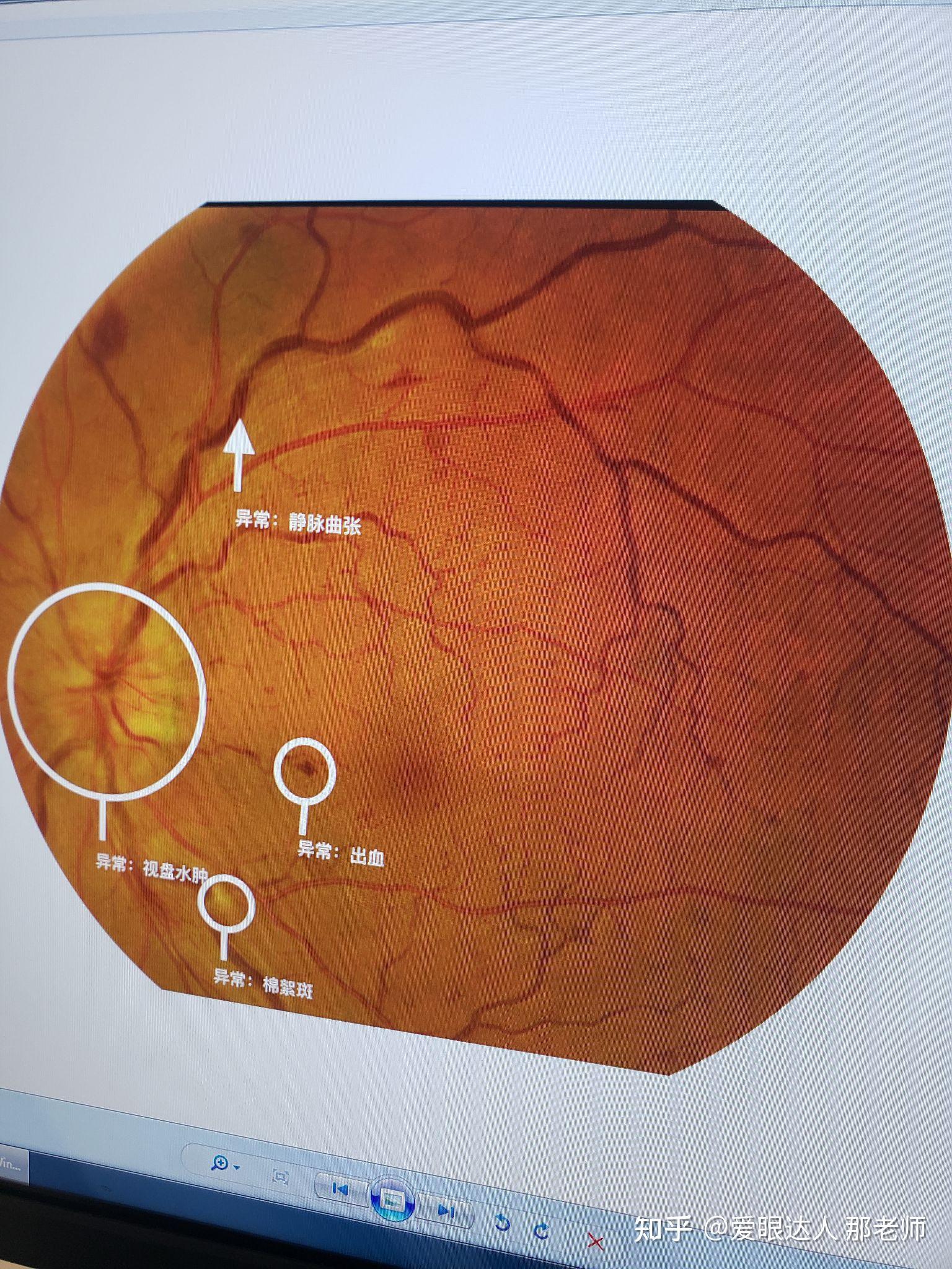 你给眼睛拍照了吗