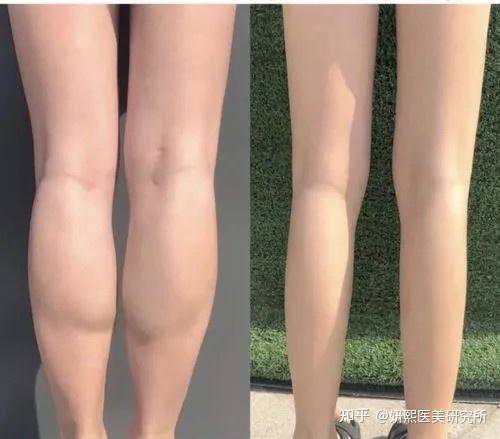 菜菜绪九头身完美比例两米大长腿原来是真实存在的