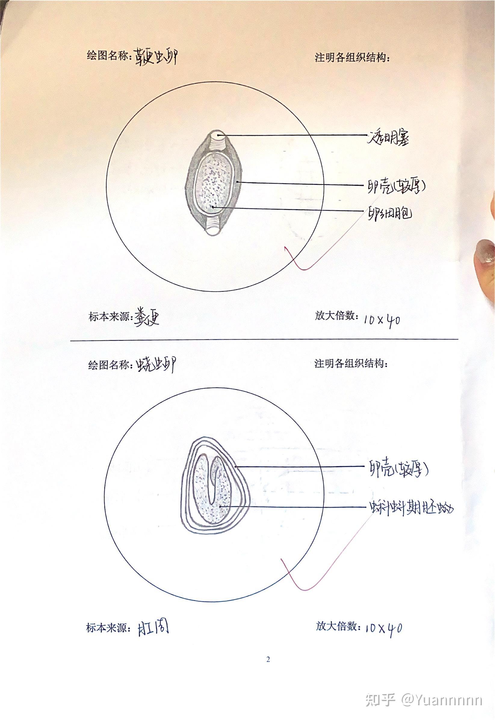 棘球蚴原头蚴结构图片