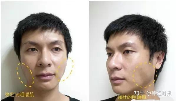 体表神经解剖:三叉神经详解 - 知乎