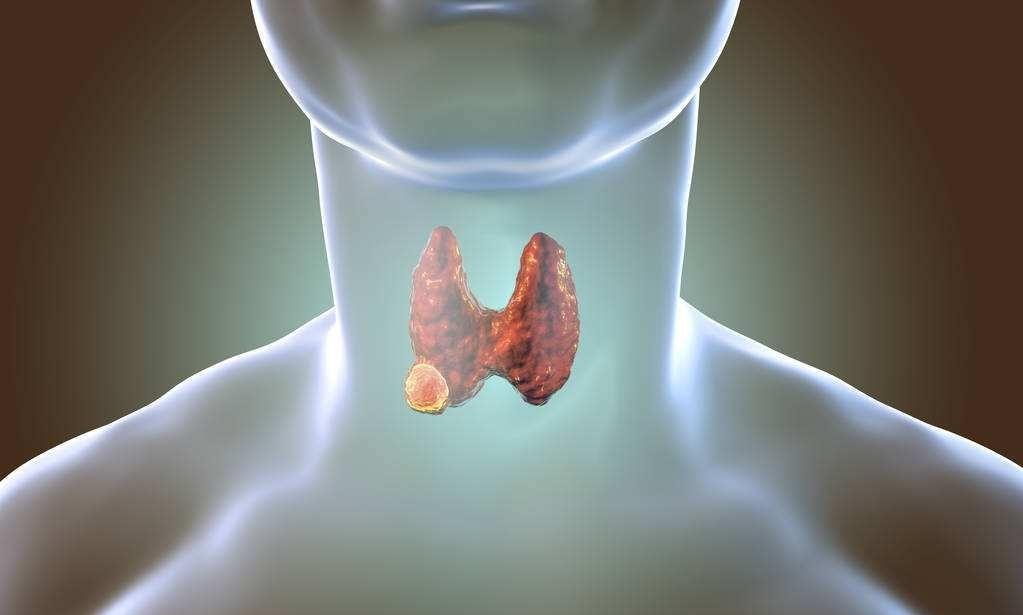 安徽中医药附属医院换了马甲照样认识你异位甲状腺