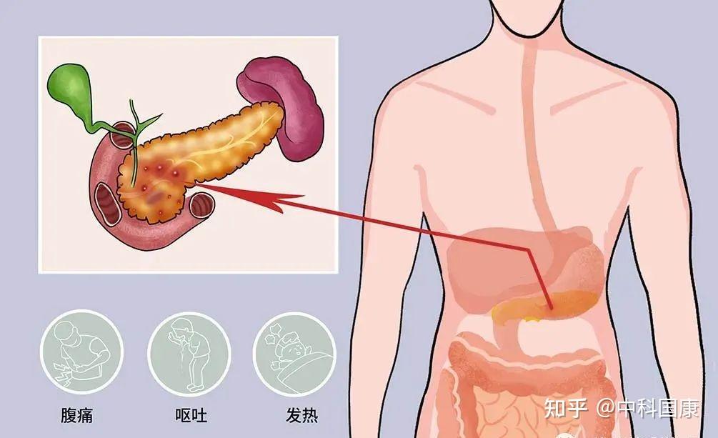 胰腺炎的护理及治疗