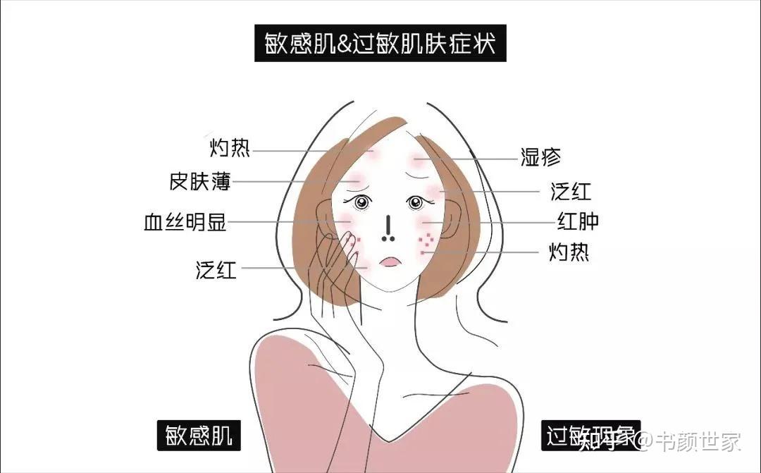 要看清楚是不是包含敏感性皮肤使用的,这样才可以避免出现过敏的情况