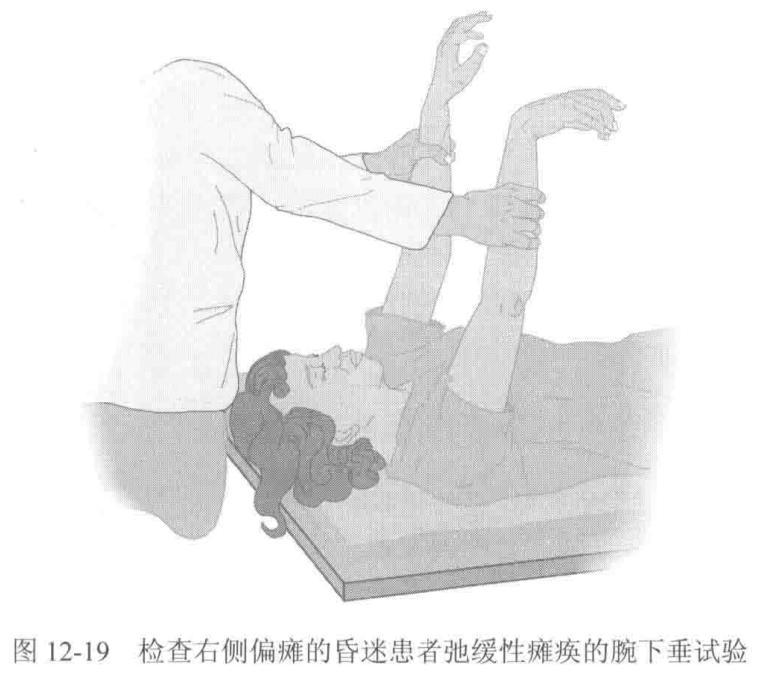 意识障碍患者的神经系统查体