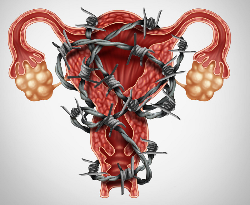 这3种常见手段都治不好子宫腺肌症浪费时间和金钱