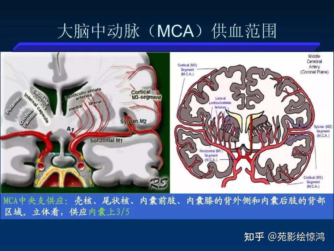 大脑中动脉皮质支图片