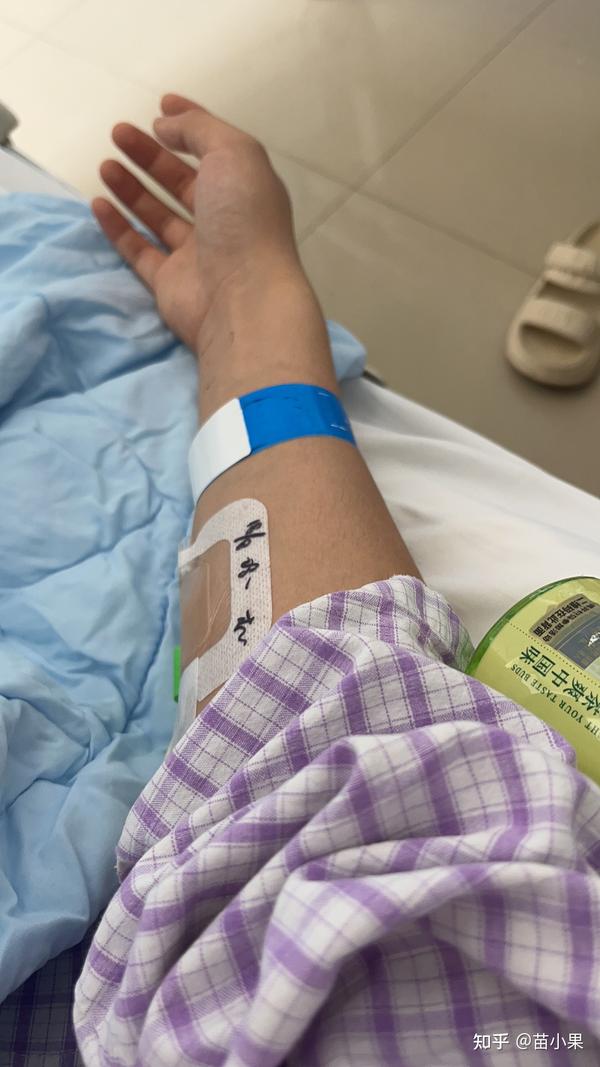 阑尾炎微创手 知乎