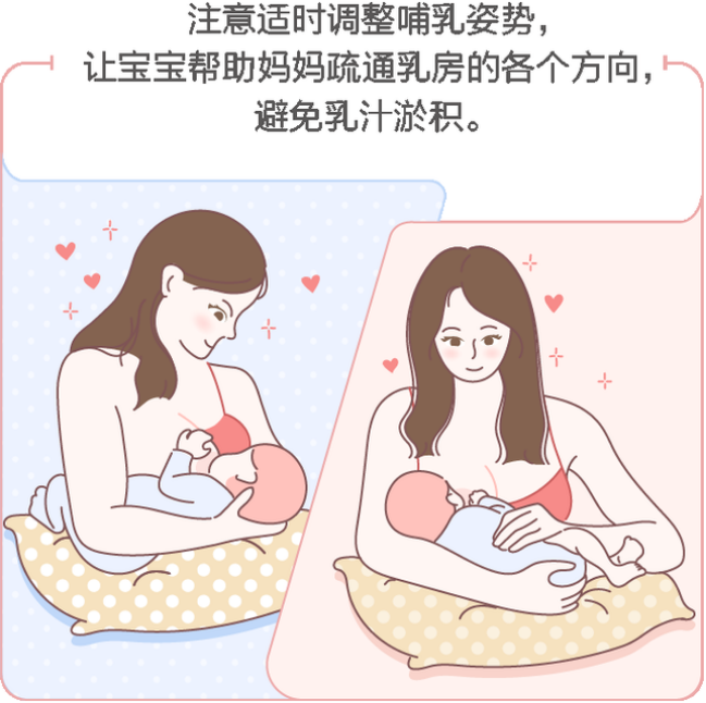 要晓得 哺乳期乳房胀痛有硬块的处理方法