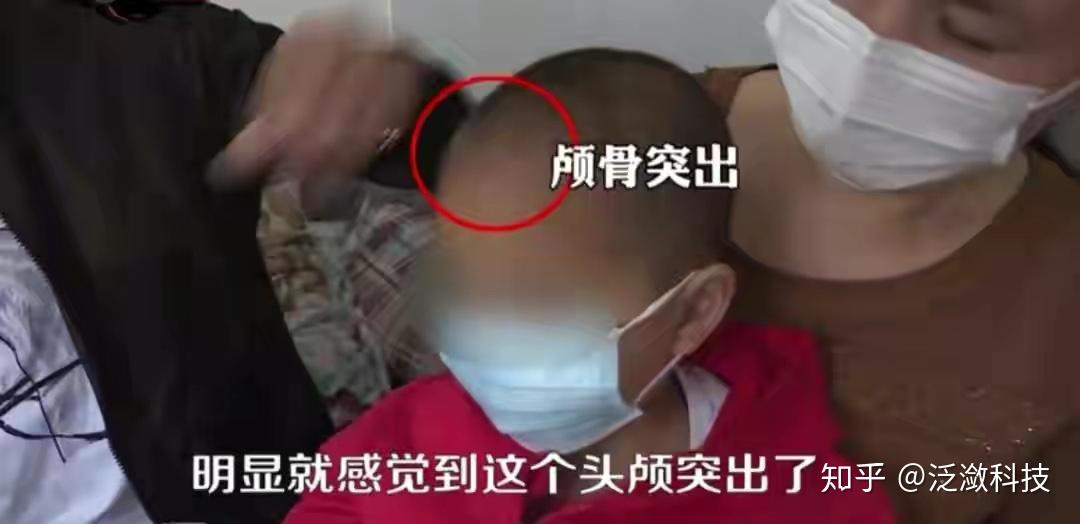 大头娃娃事件再次发生涉及的奶粉品牌有哪些如何避免踩坑