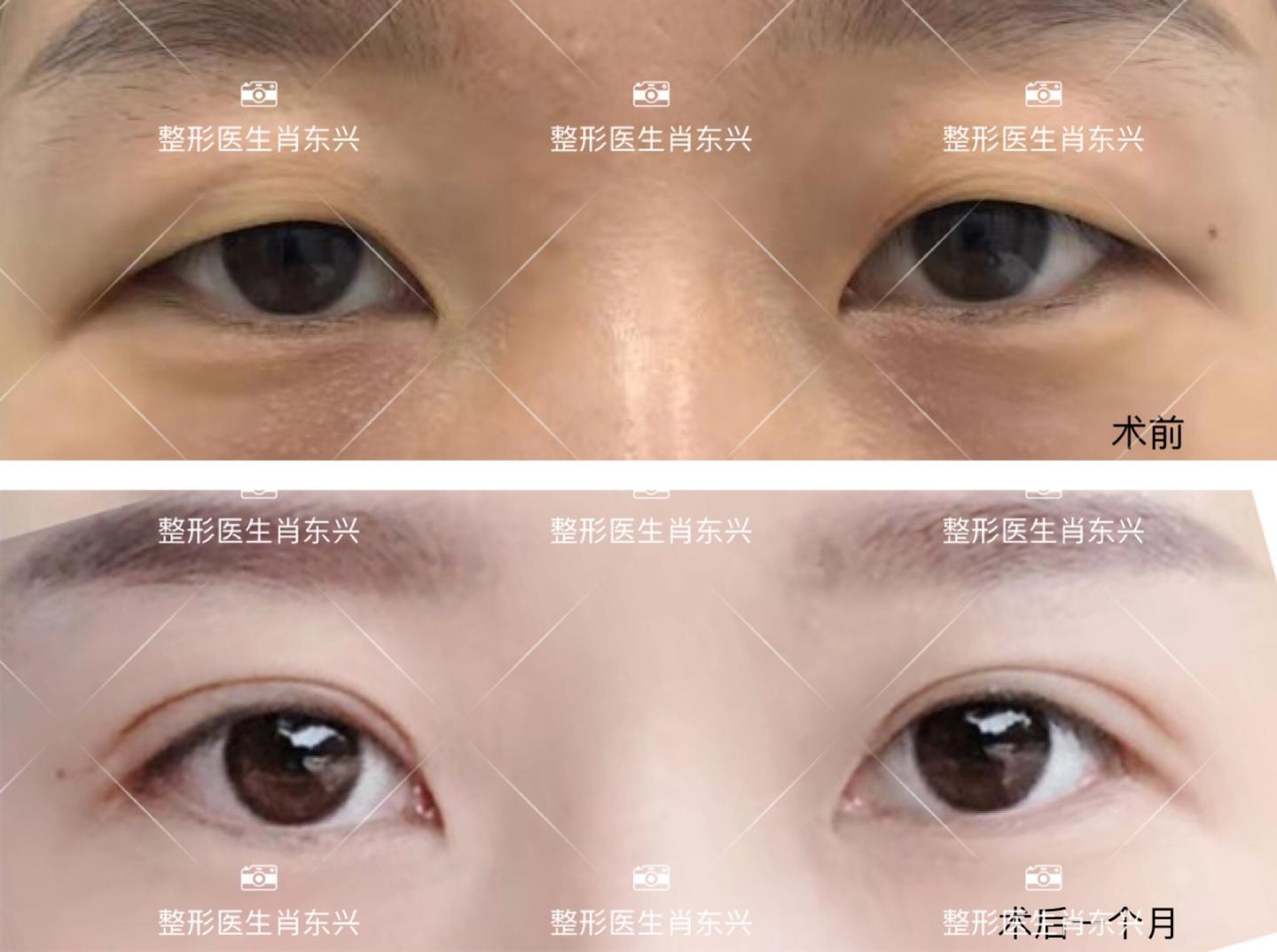 v2-f5f3bef083c4ab49c9ab61c0755d3160_1440w.jpg?source=172ae18b