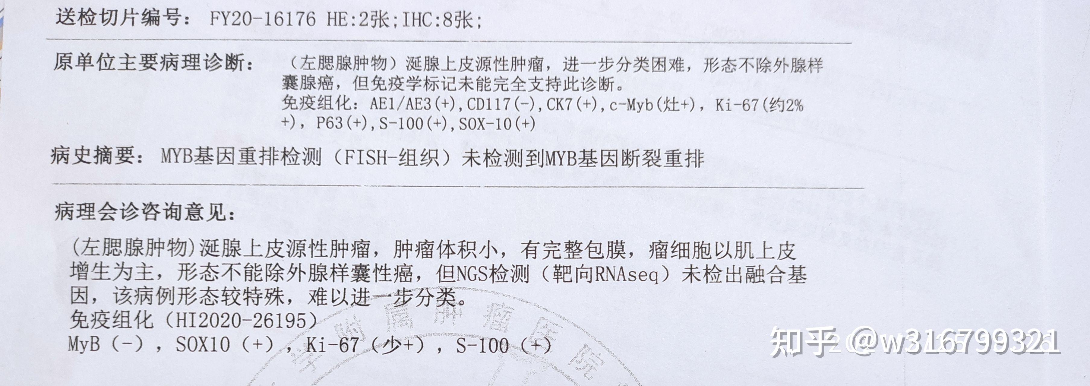 腺癌 实验报告图片