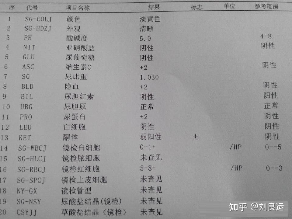 管型(cast),红细胞(rbc),白细胞(wbc),隐血(bld),尿比重(sg),酸碱度