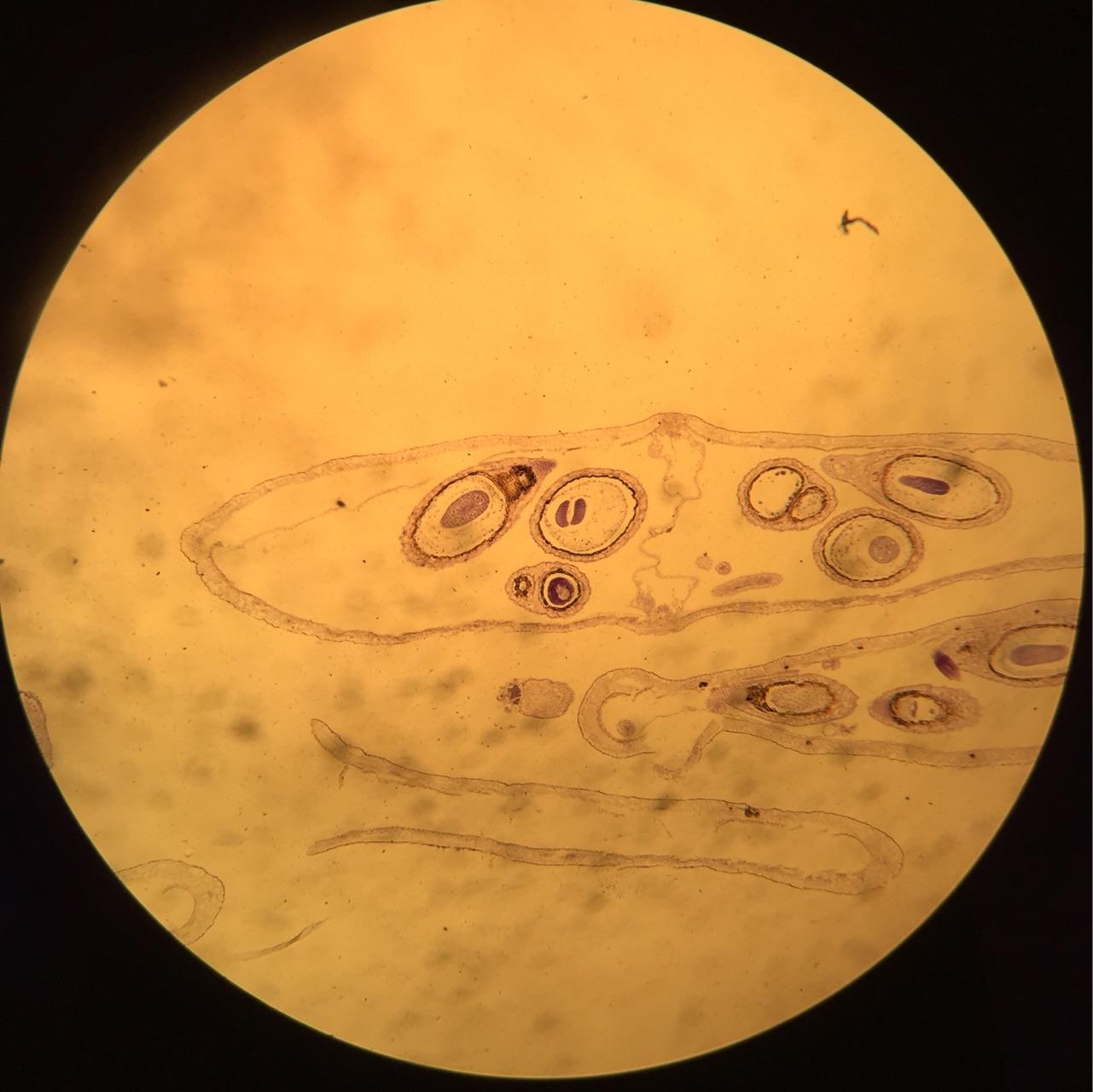 寄生虫部分显微镜下图 - 知乎