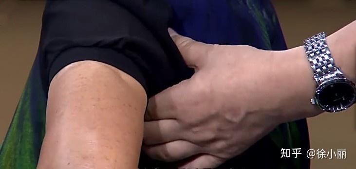 带您了解中医传统推拿技法之返魂锁——扎针埋线治疼痛