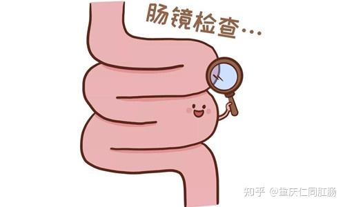 做一次肠镜检查到底能管几年