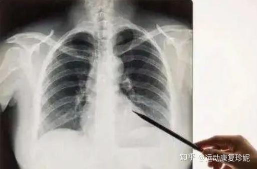 X光、CT、磁共振,区别太大了吧...(一篇文章让你速懂三者区别) - 知乎