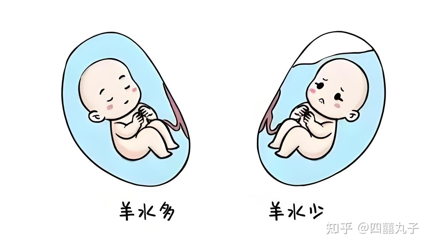 孕晚期,你一定要知道的胎位知识! - 知乎