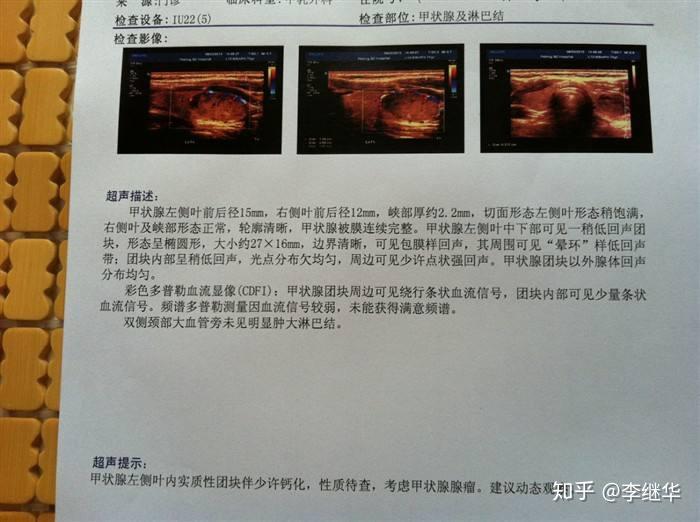 甲状腺彩超怎么做 zhuanlan.zhihu.com