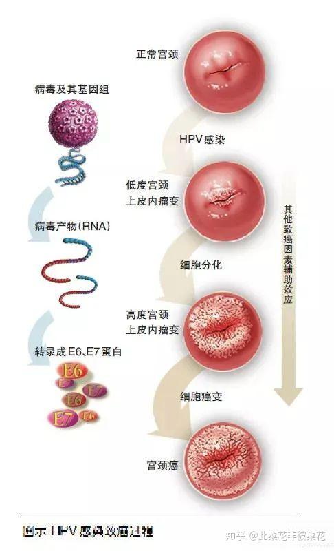 hpv的传染源、传播途径、易感人群...