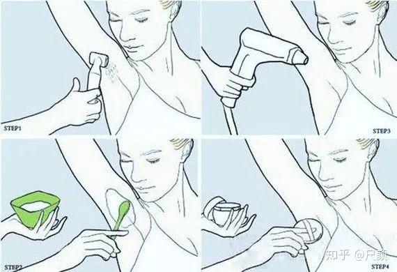 尝试了n种脱毛方法最安全彻底的是这种
