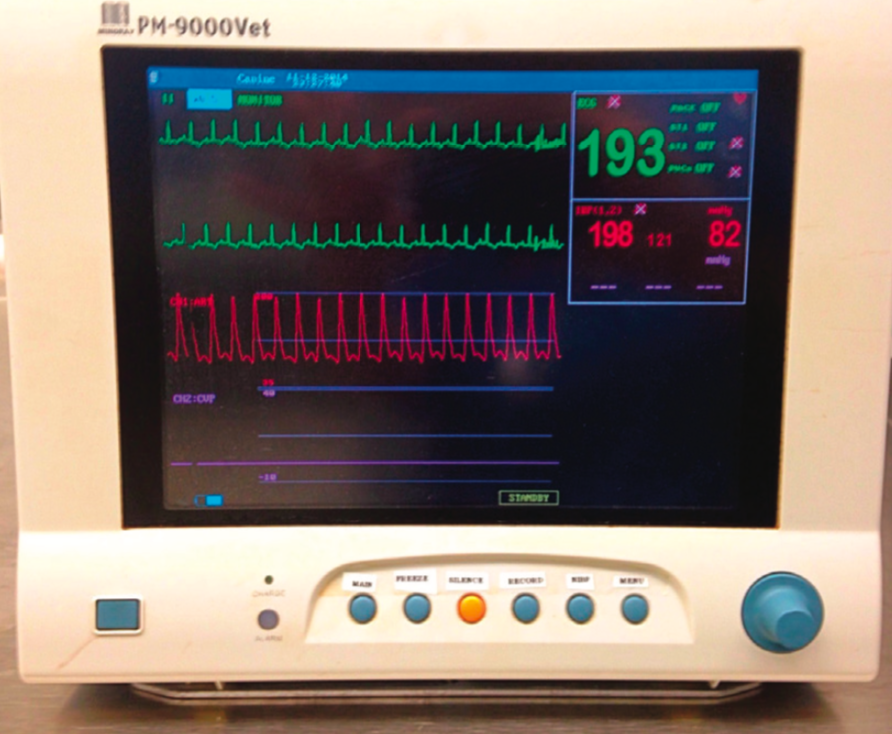 从护理角度看血压监测第二部分:血压监测技术