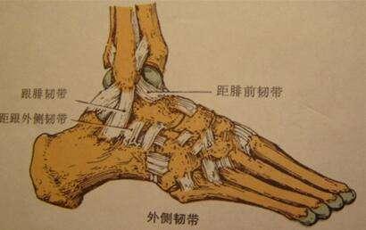 总也好不了的踝扭伤前距腓韧带损伤
