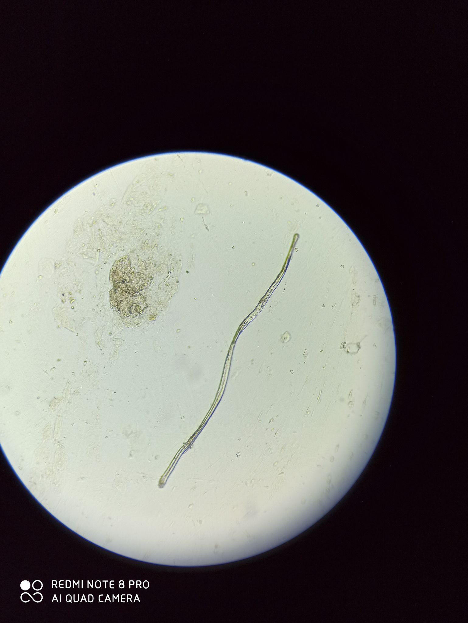 寄生虫之钻阴虫- 搜狗图片搜索