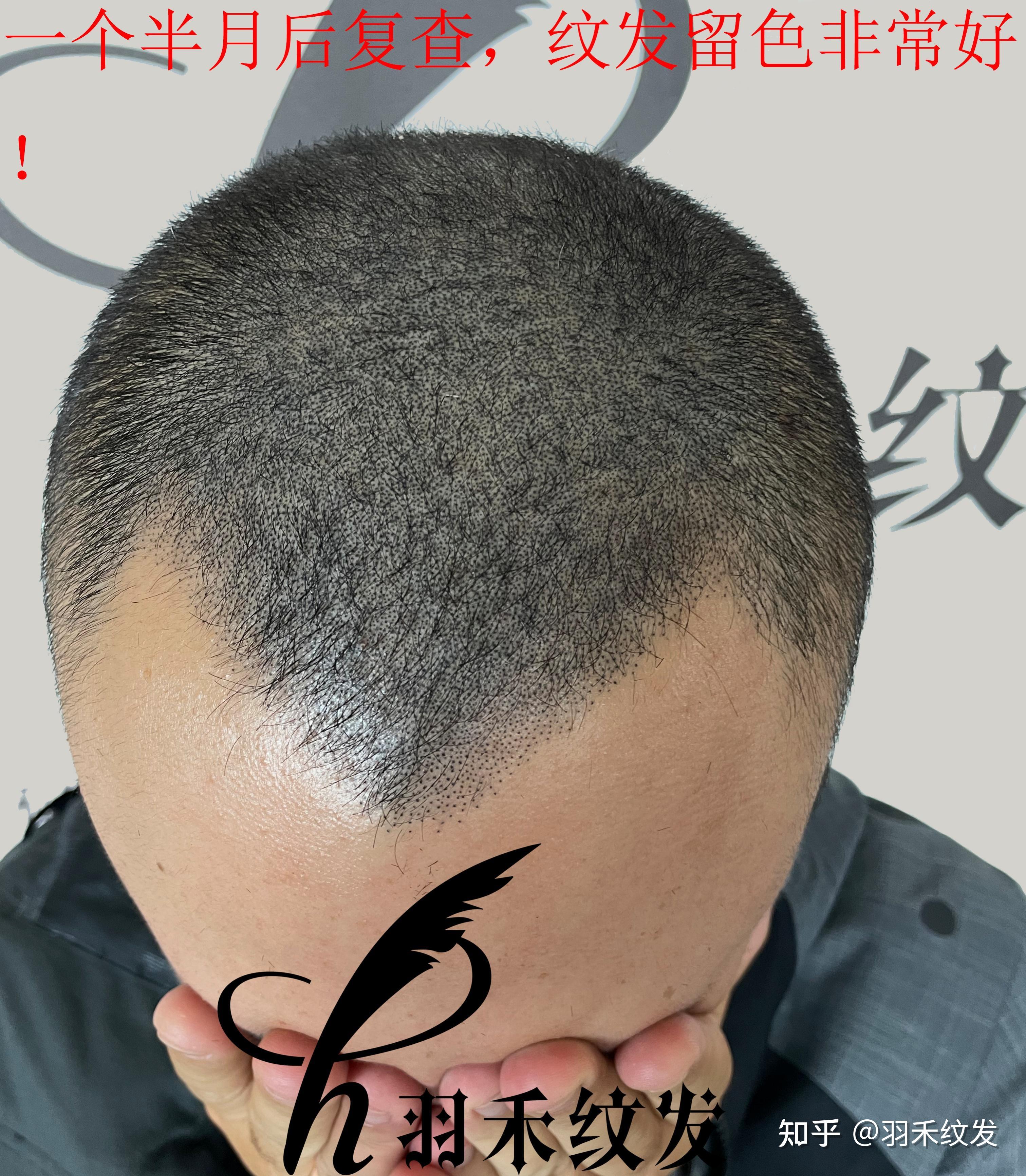 不剃头发纹发效果好吗？ - 知乎