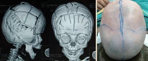 小兒頭小畸形一定是炎症聽聽專家怎麼說吧