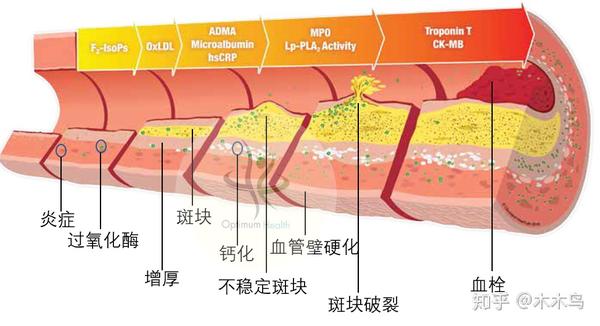 血管内皮细胞示意图图片