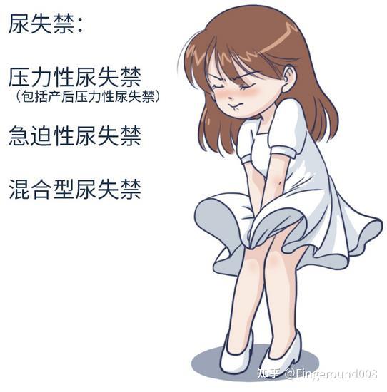 女性尿失禁有什么方法可以改善