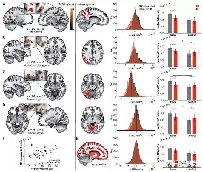 Science: 快速追踪新皮质:后顶叶皮层的记忆印迹 - 知乎