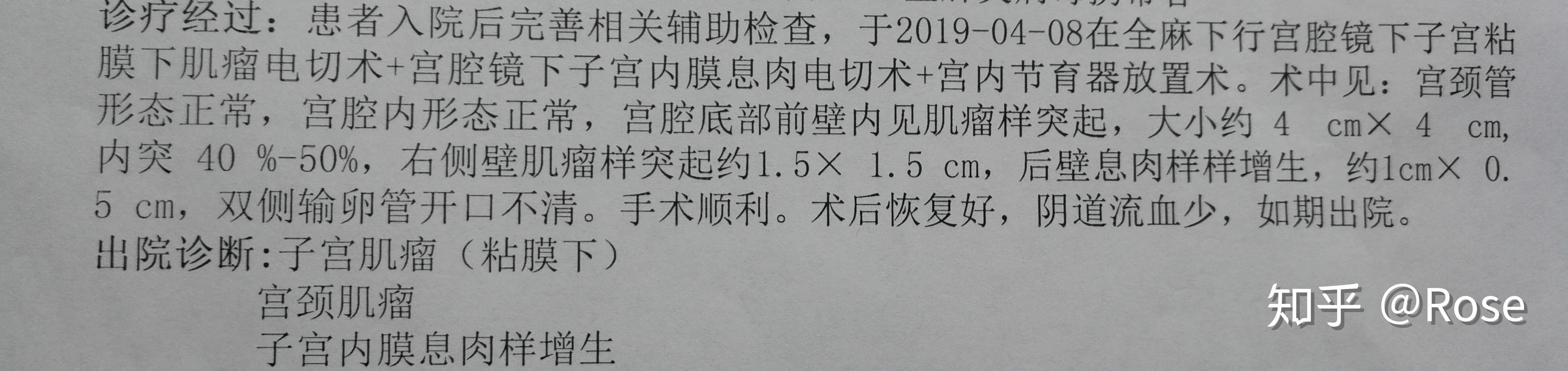 宮腔鏡檢查及手術過程分享