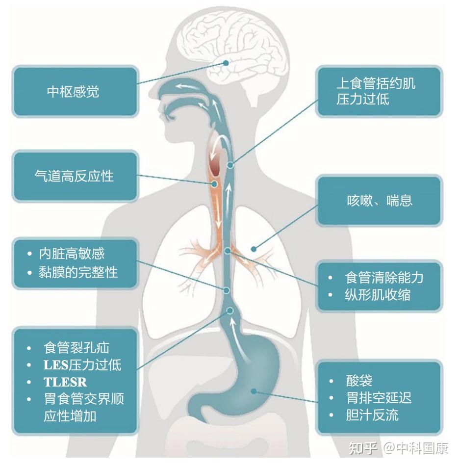 胃食管反流病思维导图图片