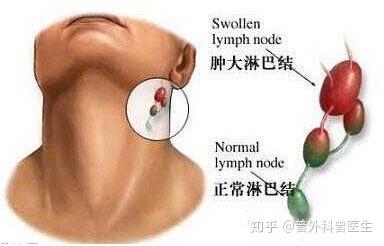 癌症可以出现三个症状 很多人都忽视了 延误了治疗时机 知乎