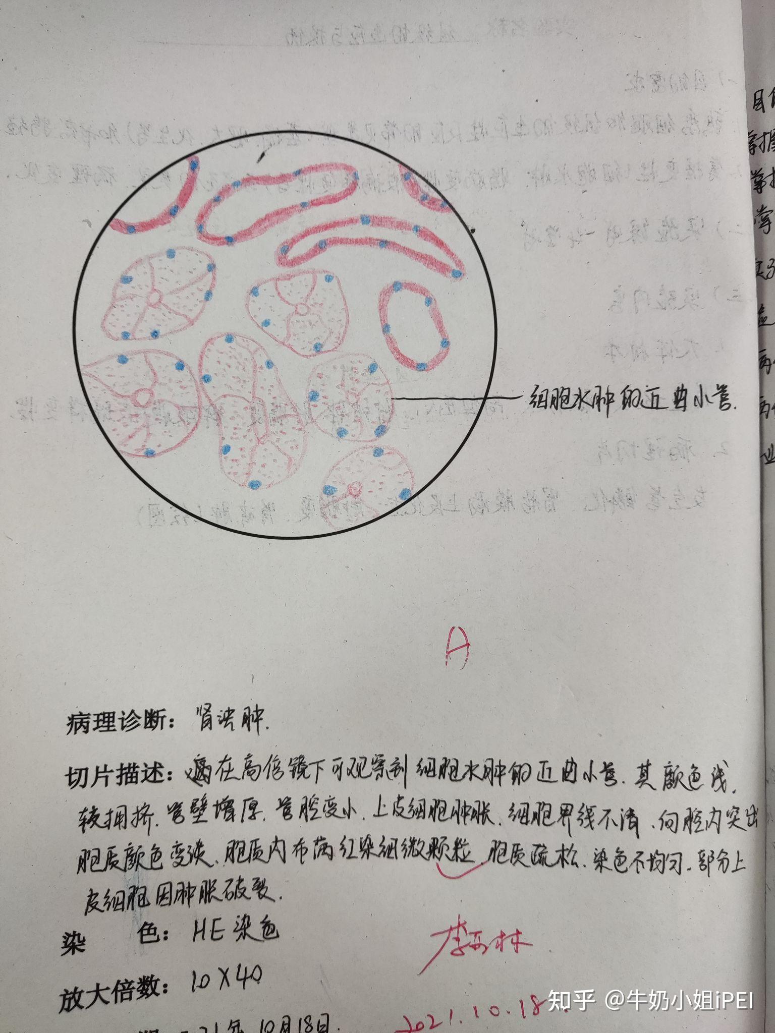 病理学实验报告红蓝铅笔绘图