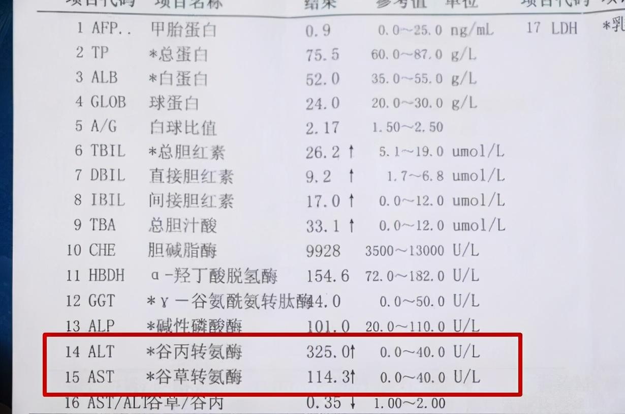 肝功能检查要空腹吗图片