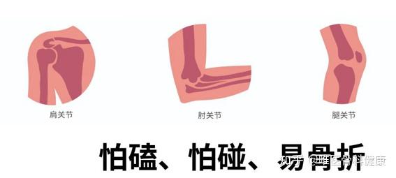 脆骨病有什么表现?