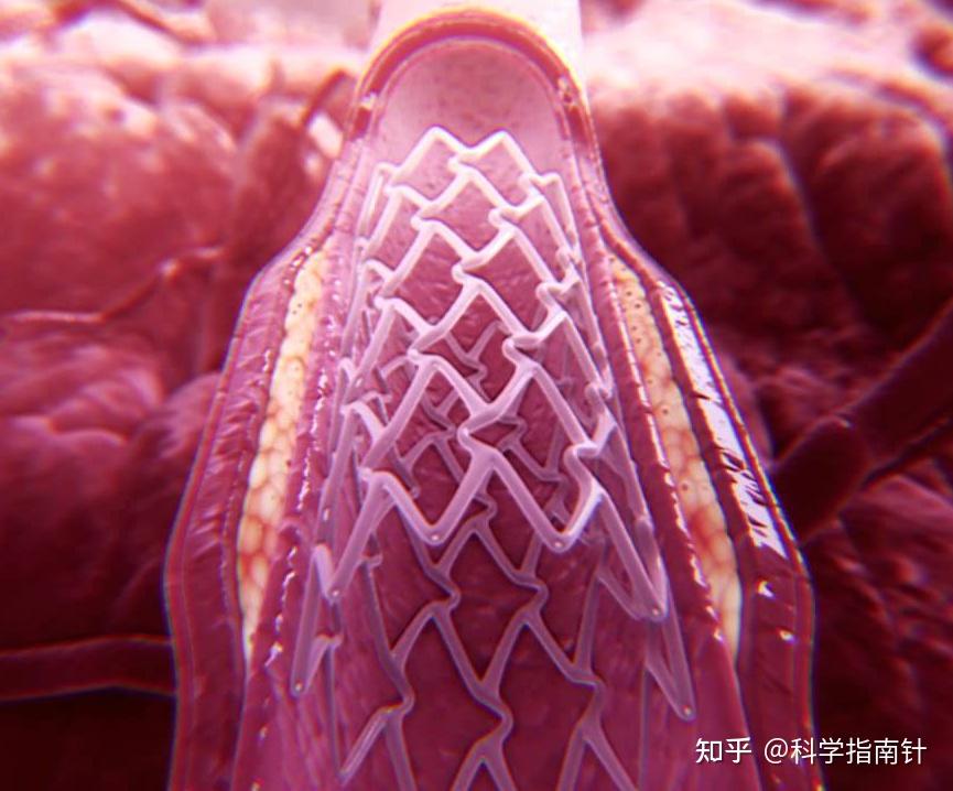 什么是生物材料? 知乎