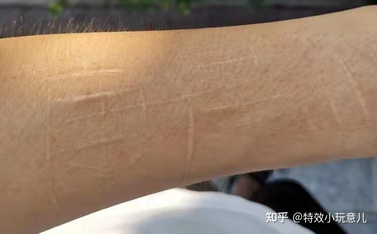 公安体检手臂疤痕遮盖 - 知乎