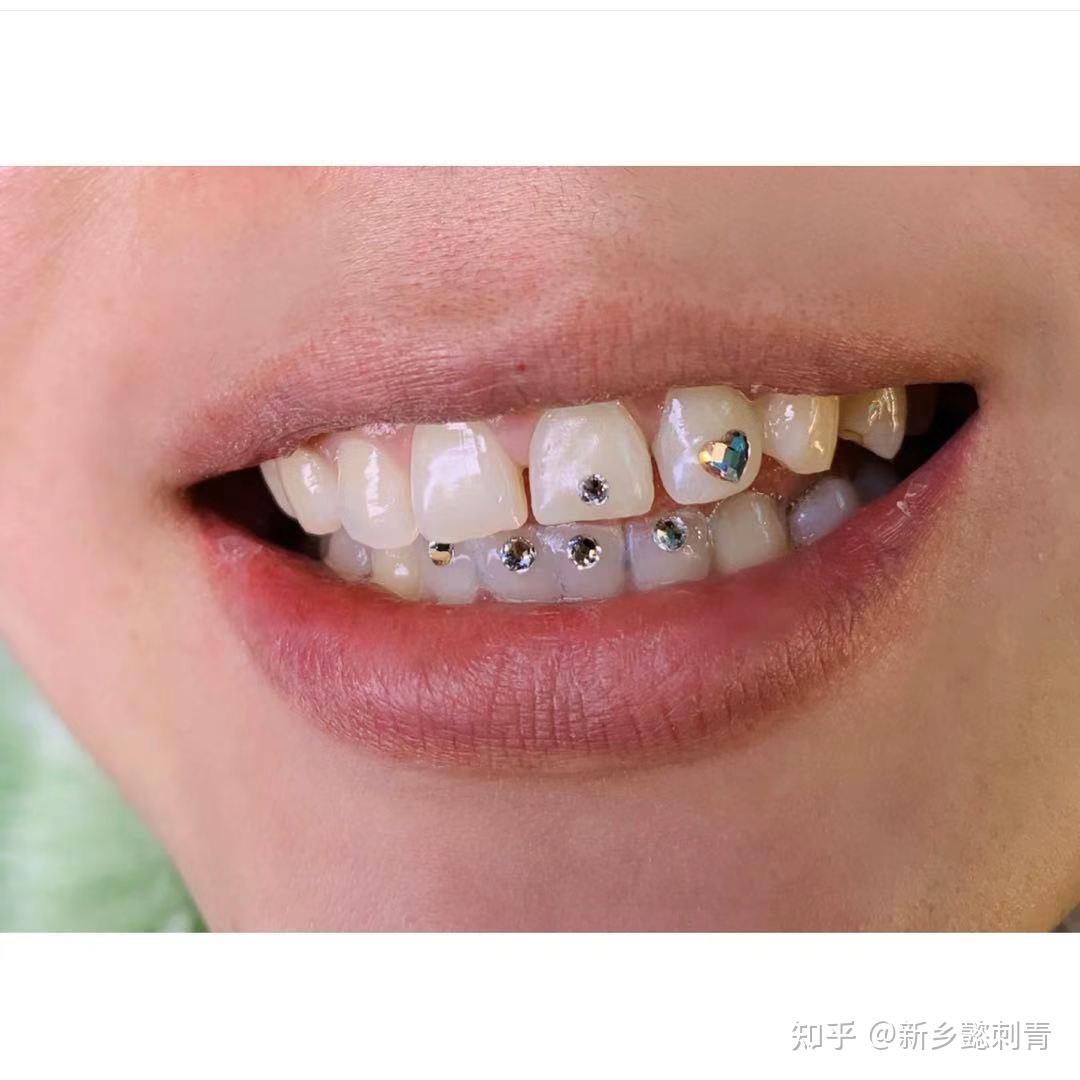 镶钻的女性牙齿-欧莱凯设计网