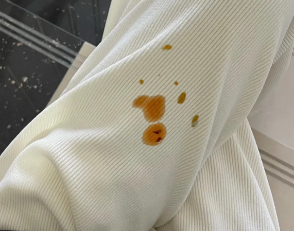 油渍弄到衣服上怎么洗干净啊?最好是不用洗整件衣服的办法!教你一招,顽固油渍也能轻松拿下!