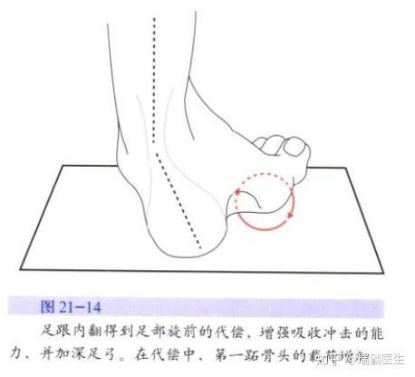 瑞麟医生带您读矫形外科原则七步态