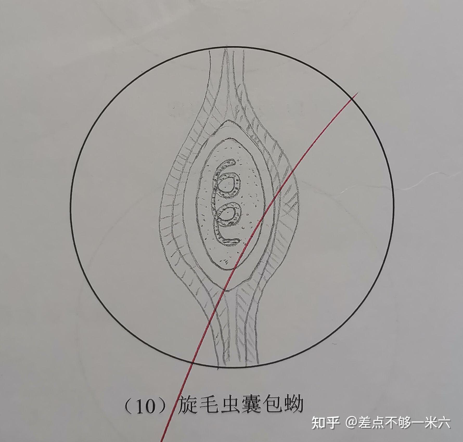 微丝蚴图片手绘图图片