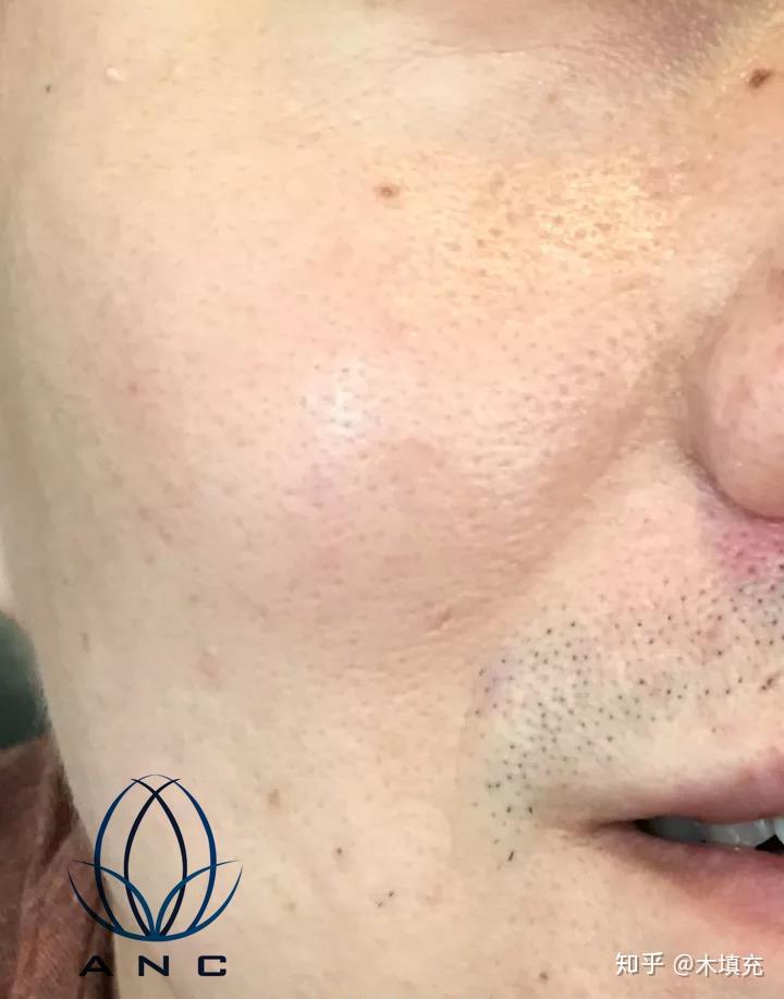 皮下男 zhuanlan.zhihu.com