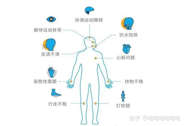 最常见的共济失调症状