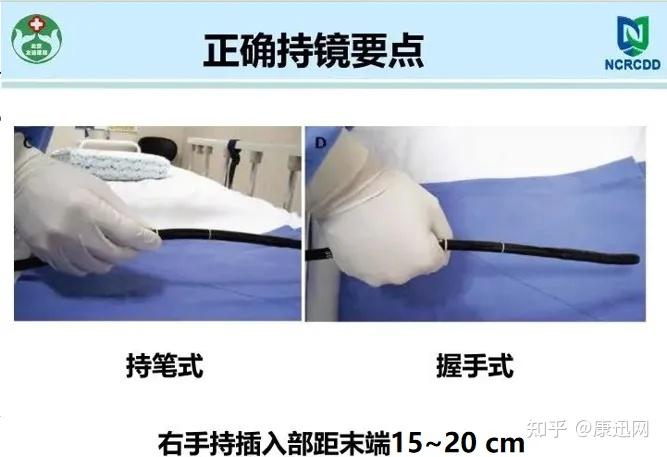 实用！胃镜操作及报告撰写规范分享丨课件分享 - 知乎