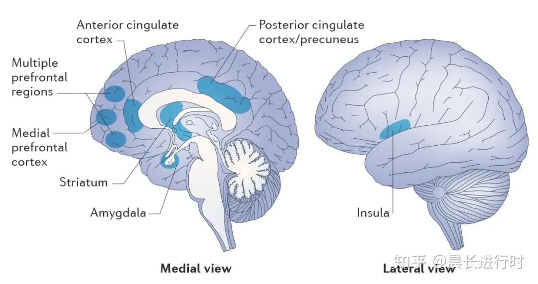 上纵束superior longitudinal fasciculus;胼胝体corpus callosum