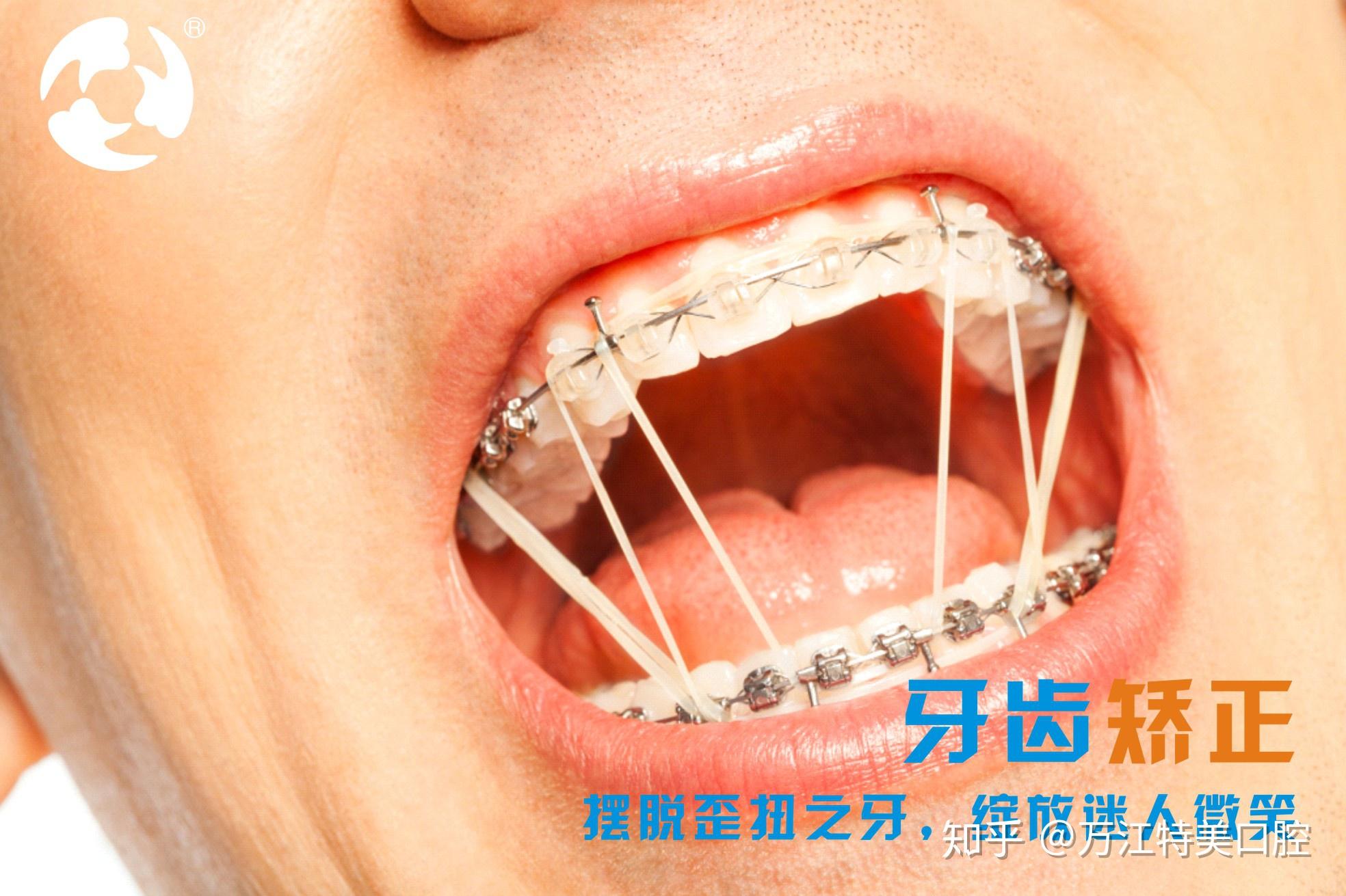 拔牙后七天窟窿恢复图解（拔牙后最怕的是"牙洞"的恢复期！需要多久才能愈合？） | 说明书网