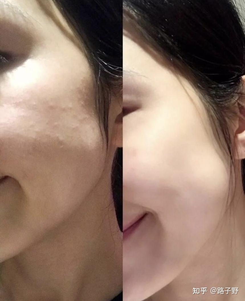 常年熬夜脸还有机会变白吗